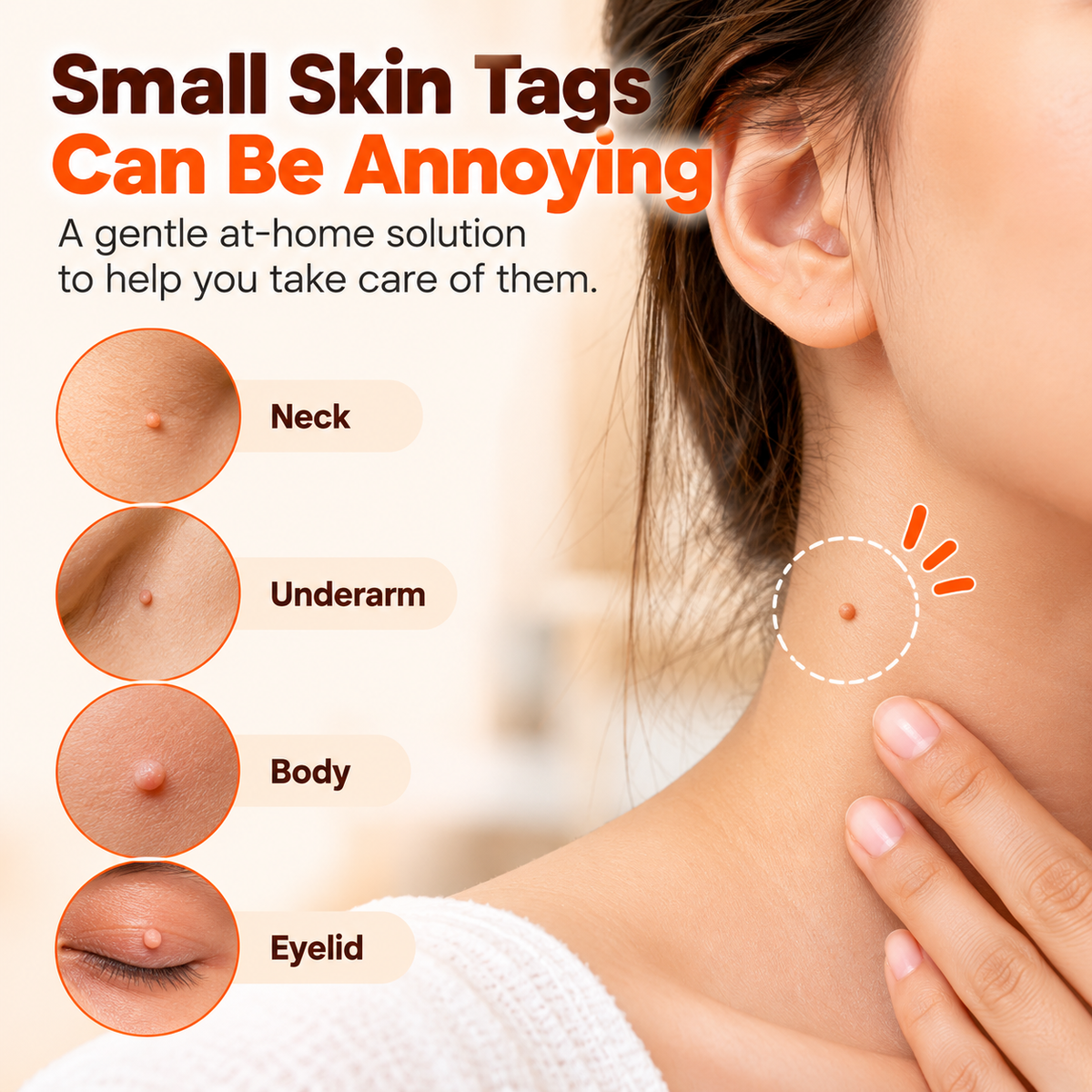 Skin Tag Remover Patches