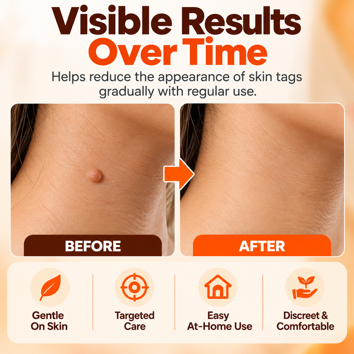Skin Tag Remover Patches