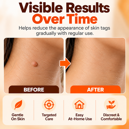Skin Tag Remover Patches